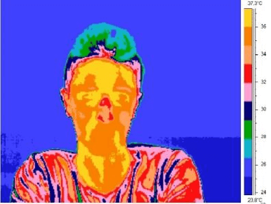Egy arc hőkamera-képe, melyen megfigyelhető a Pinokkió-effektus.